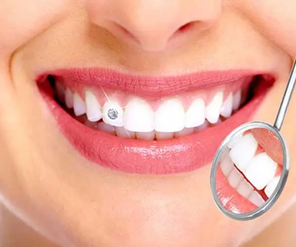 Tooth Jewellery